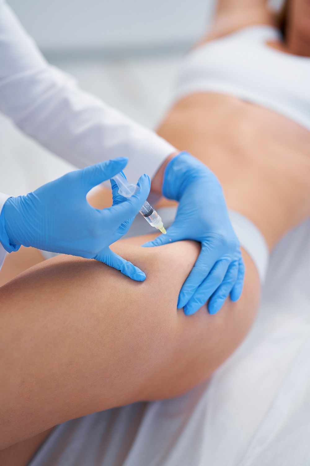 BIOESTIMULACIÓN CON PLASMA RICO EN PLAQUETAS