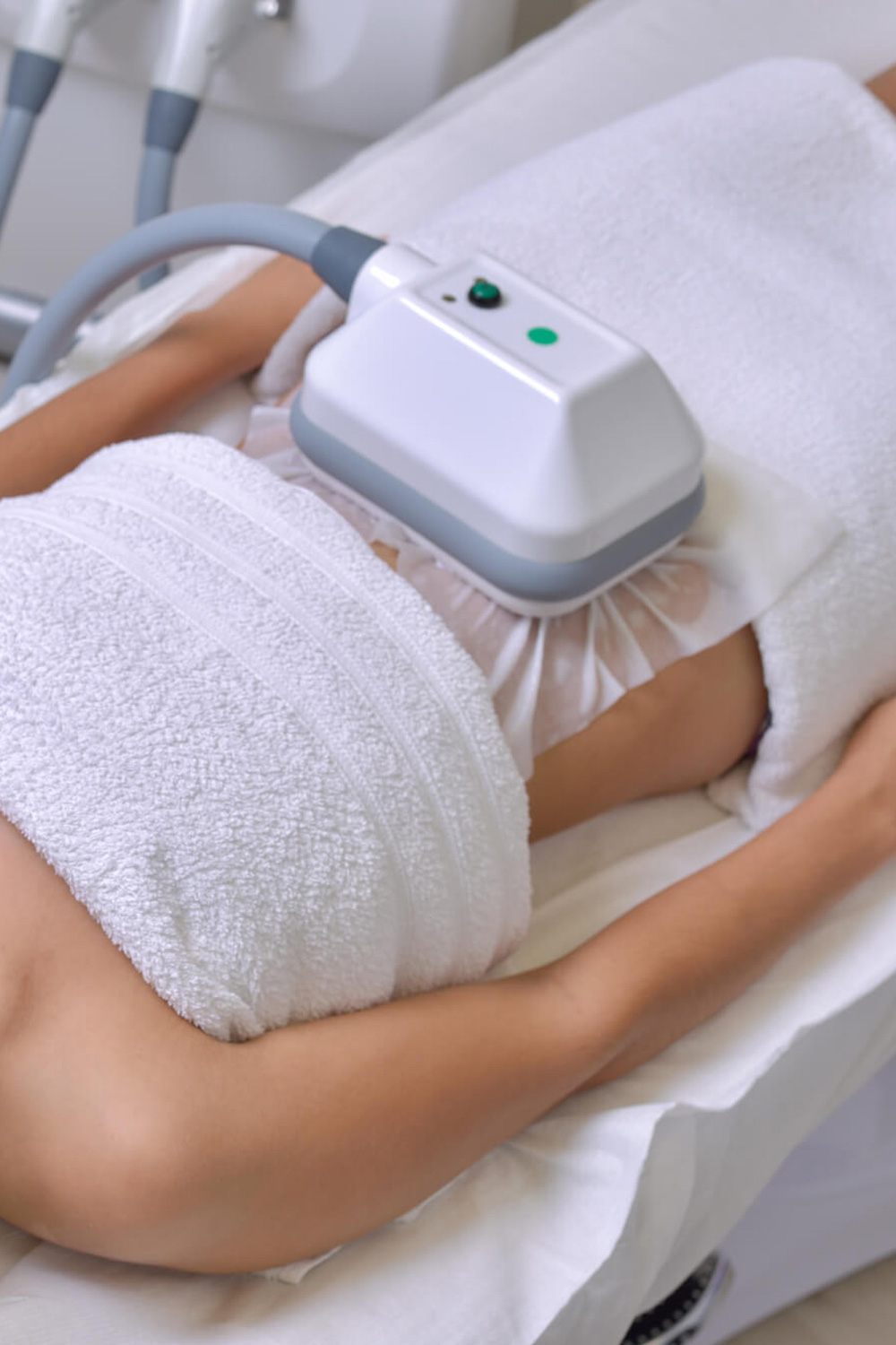 CRIOLIPOLISIS – COOLTECH