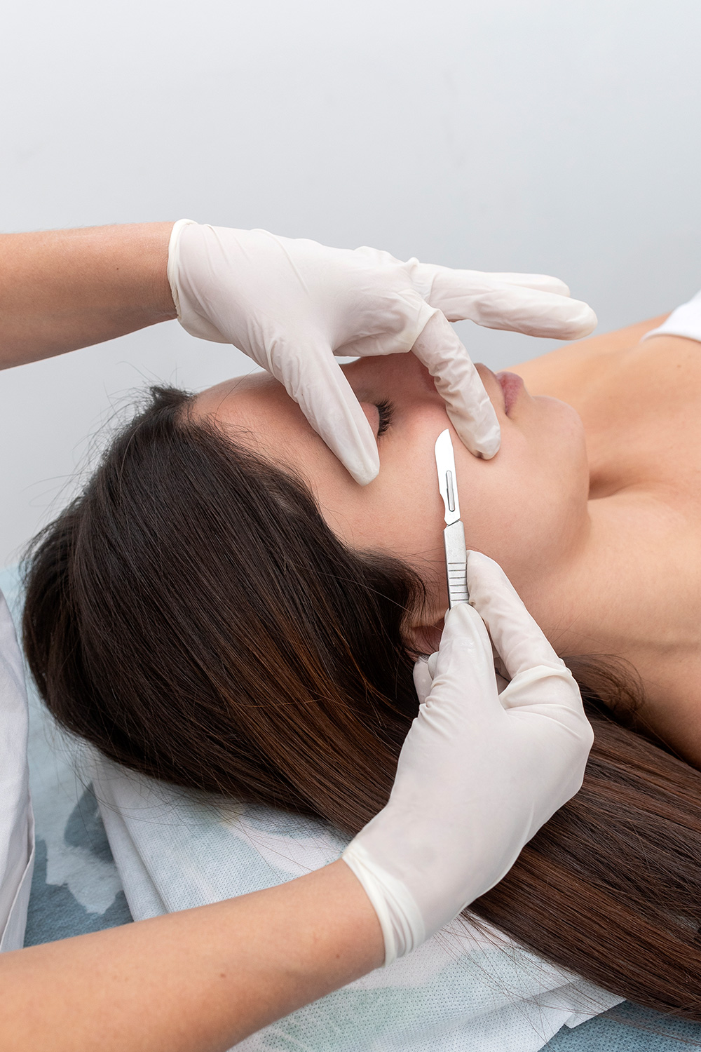 DERMAPLANING